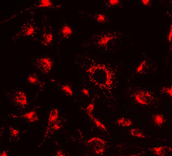 溶酶体橙色荧光探针 现货低价销售 原装进口 货号22644
