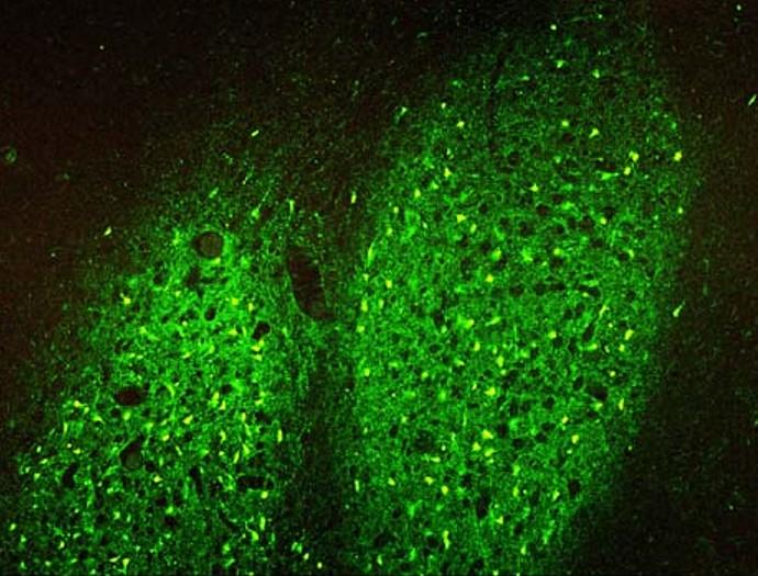 荧光探针 Fluoro-Jade C  货号23062