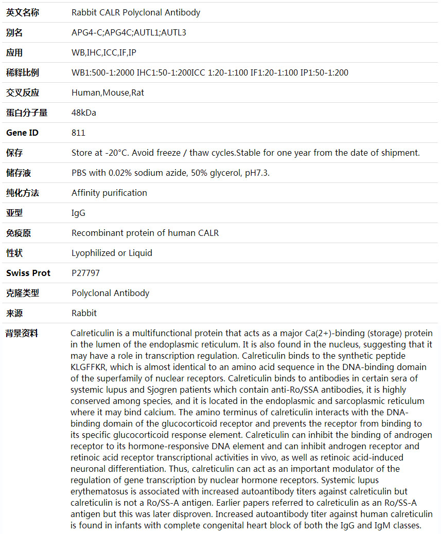 Anti-CALR Polyclonal Antibody,索莱宝,K002071P-100ul