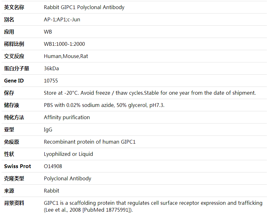 Anti-GIPC1 Polyclonal Antibody,索莱宝,K002041P-100ul