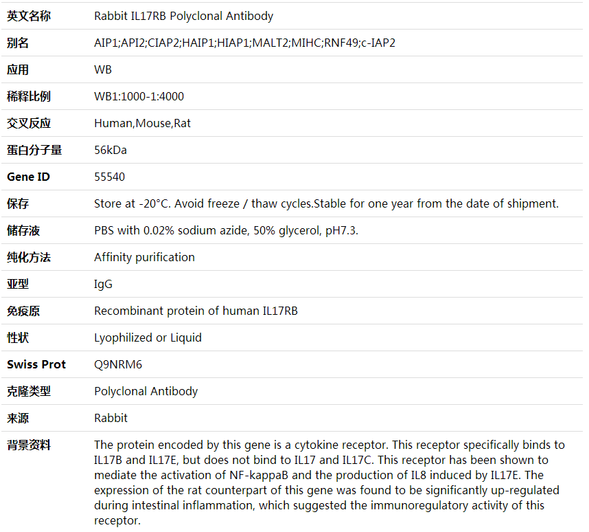 Anti-IL17RB Polyclonal Antibody,索莱宝,K001862P-100ul