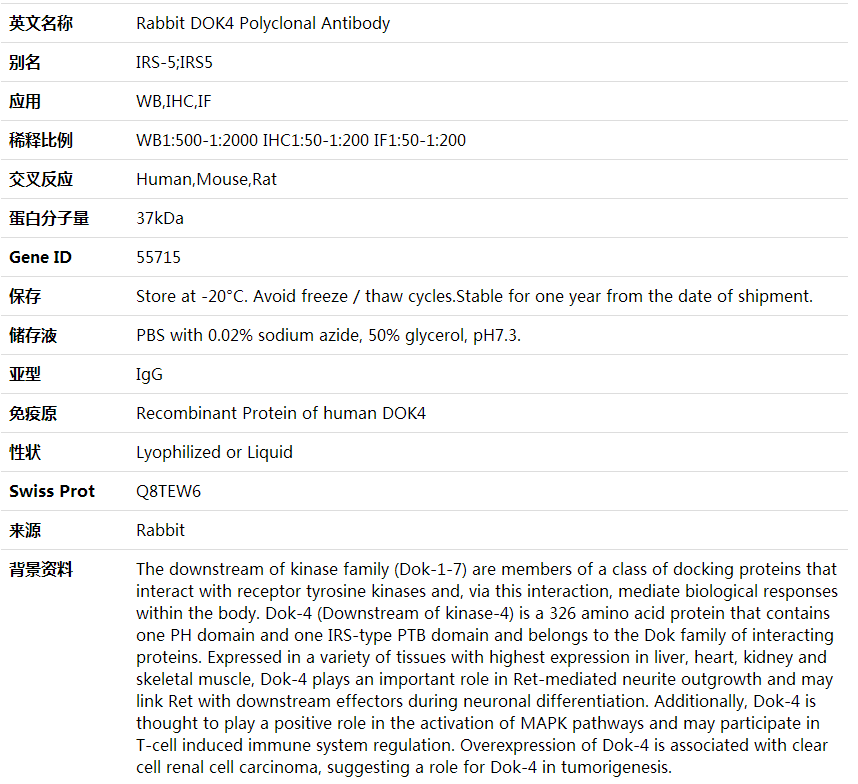 Anti-DOK4 Polyclonal Antibody,索莱宝,K001609P-30ul