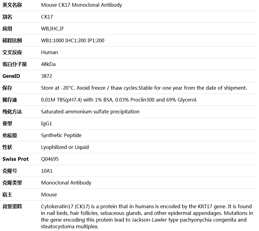 CK17 Antibody,索莱宝,K000206M-50ul