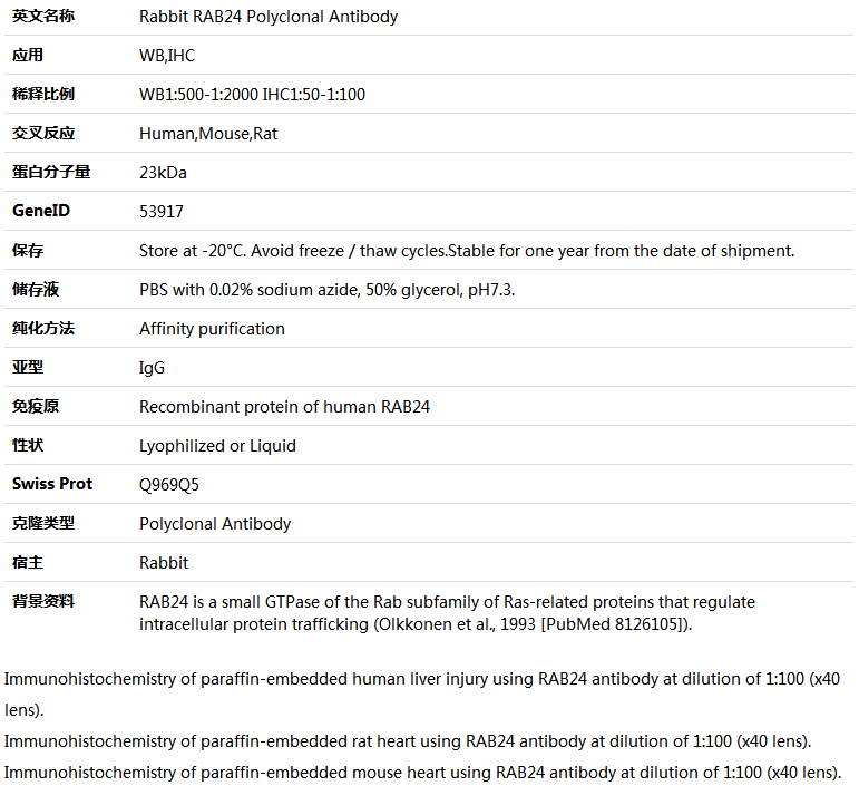 RAB24 Antibody,索莱宝,K005804P-50ul
