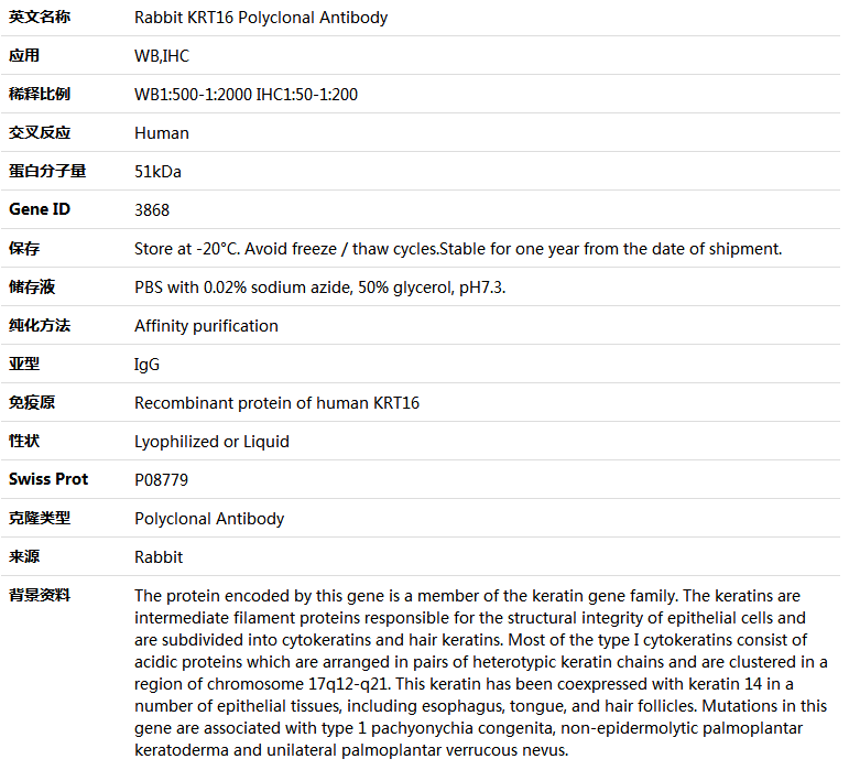 KRT16 Antibody,索莱宝,K005289P-50ul