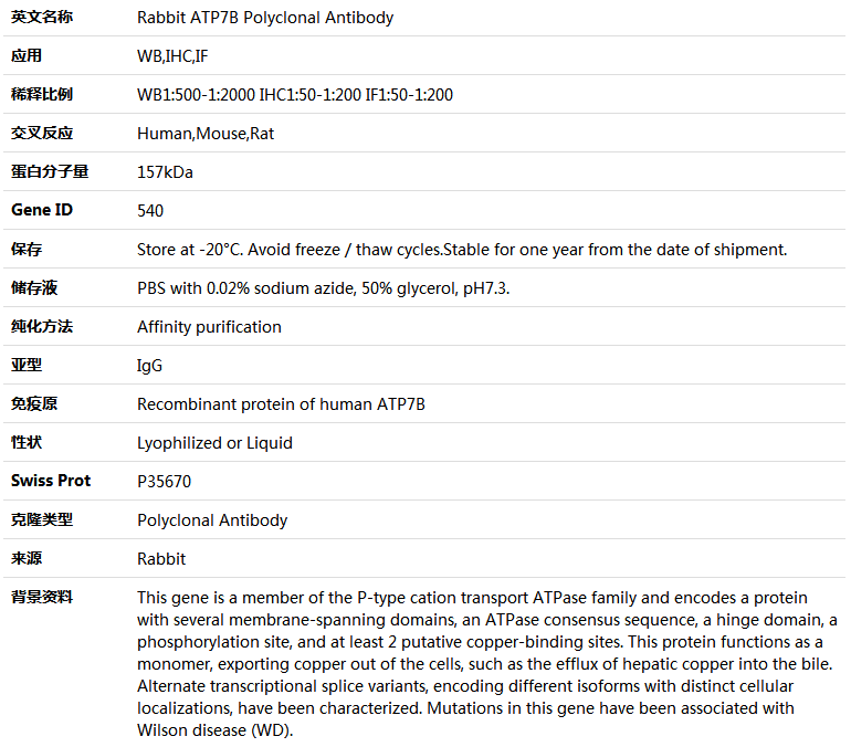 ATP7B Antibody,索莱宝,K004129P-100ul