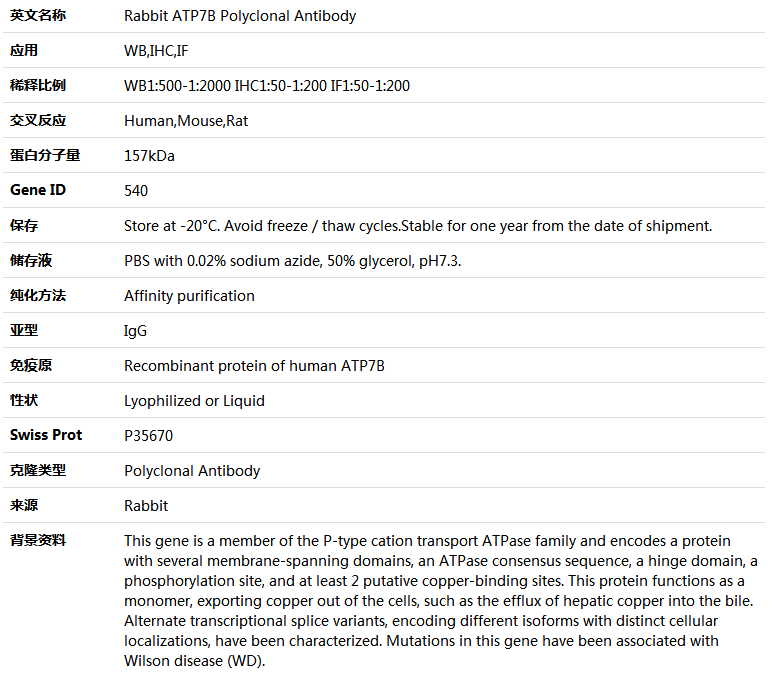 ATP7B Antibody,索莱宝,K004129P-50ul